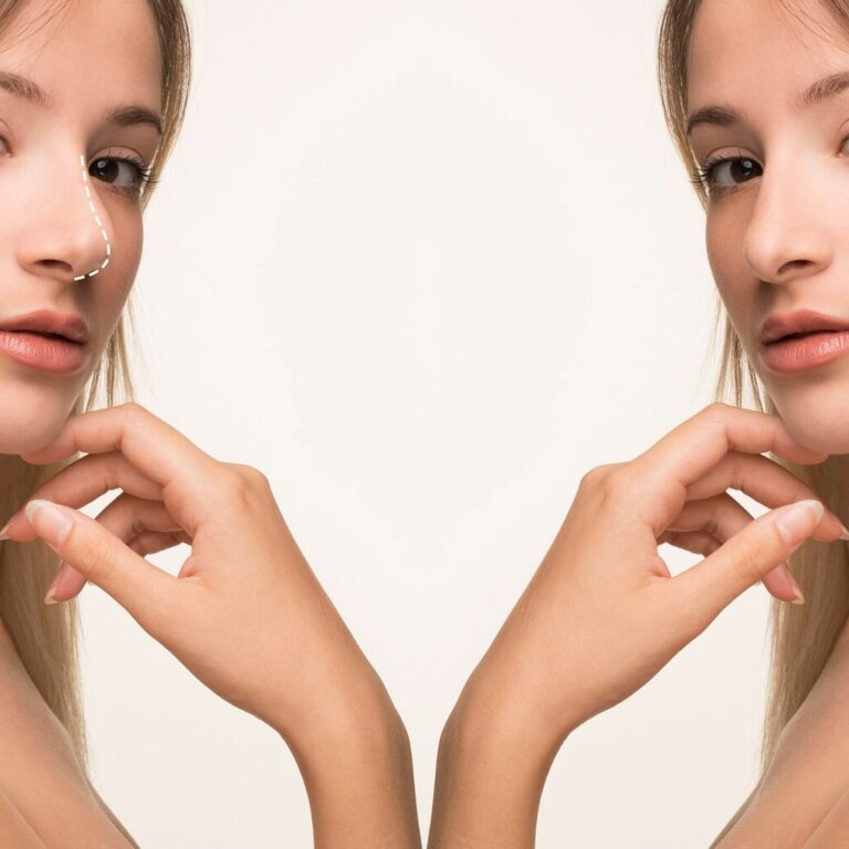 rhinoplasty-surgery-concept-with-woman-model_23-2150036910